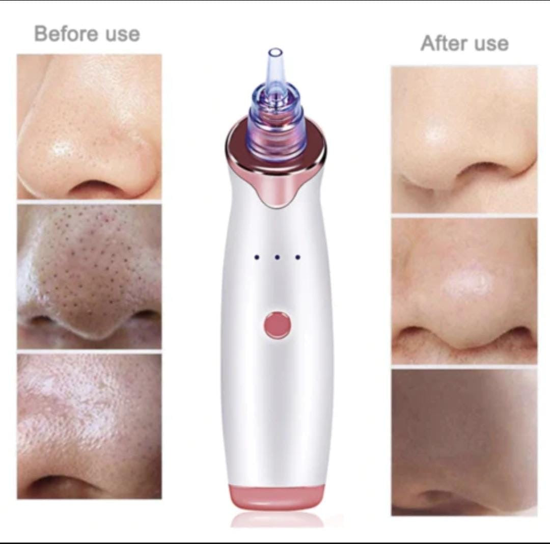 Vaccum Pore Cleaner